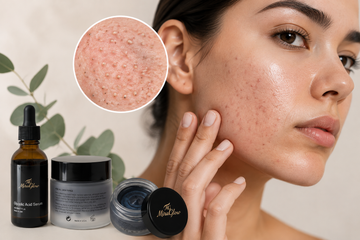 Congested skin with textured breakouts and clogged pores alongside MiraGlow skincare products for clearer-looking skin.