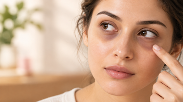 Real Reason Your Dark Circles Aren't Fading